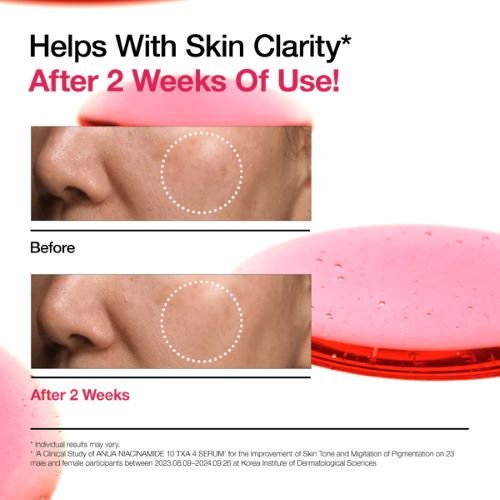 anua-us-ampoule-serum-30ml-niacinamide-10-txa-4-serum-1161173075